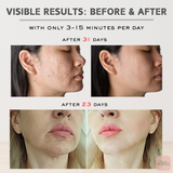 FaceScaper™ 7 in 1 Facial Device