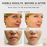 FaceScaper™ 7 in 1 Facial Device